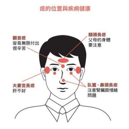 右邊臉頰有痣|臉上有痣一定要點掉嗎？命理師大師：錯！「這兩種」。